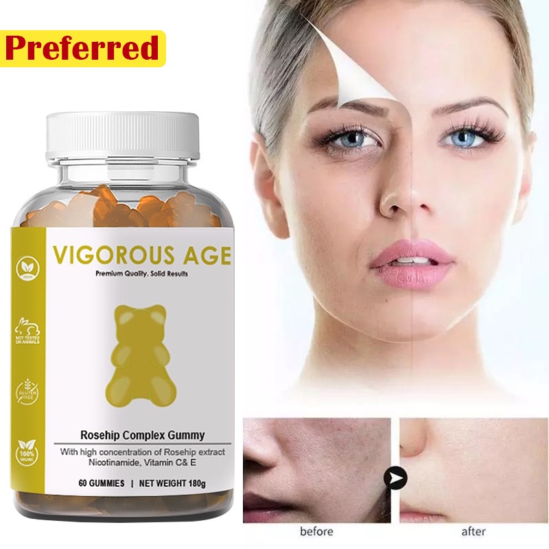 VIGOROUS AGE Collagen Gummies with Niacinamide Vitamins C & E Skin