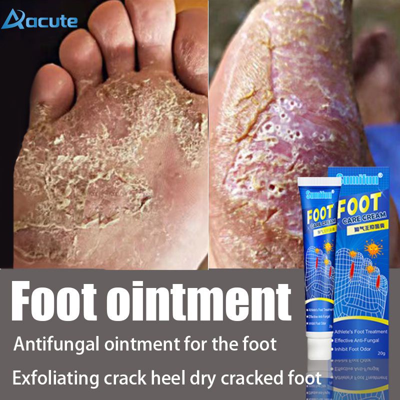 Foot Care Cream Athlete Foot Cream Athlete's Foot Tinea Beriberi Bad