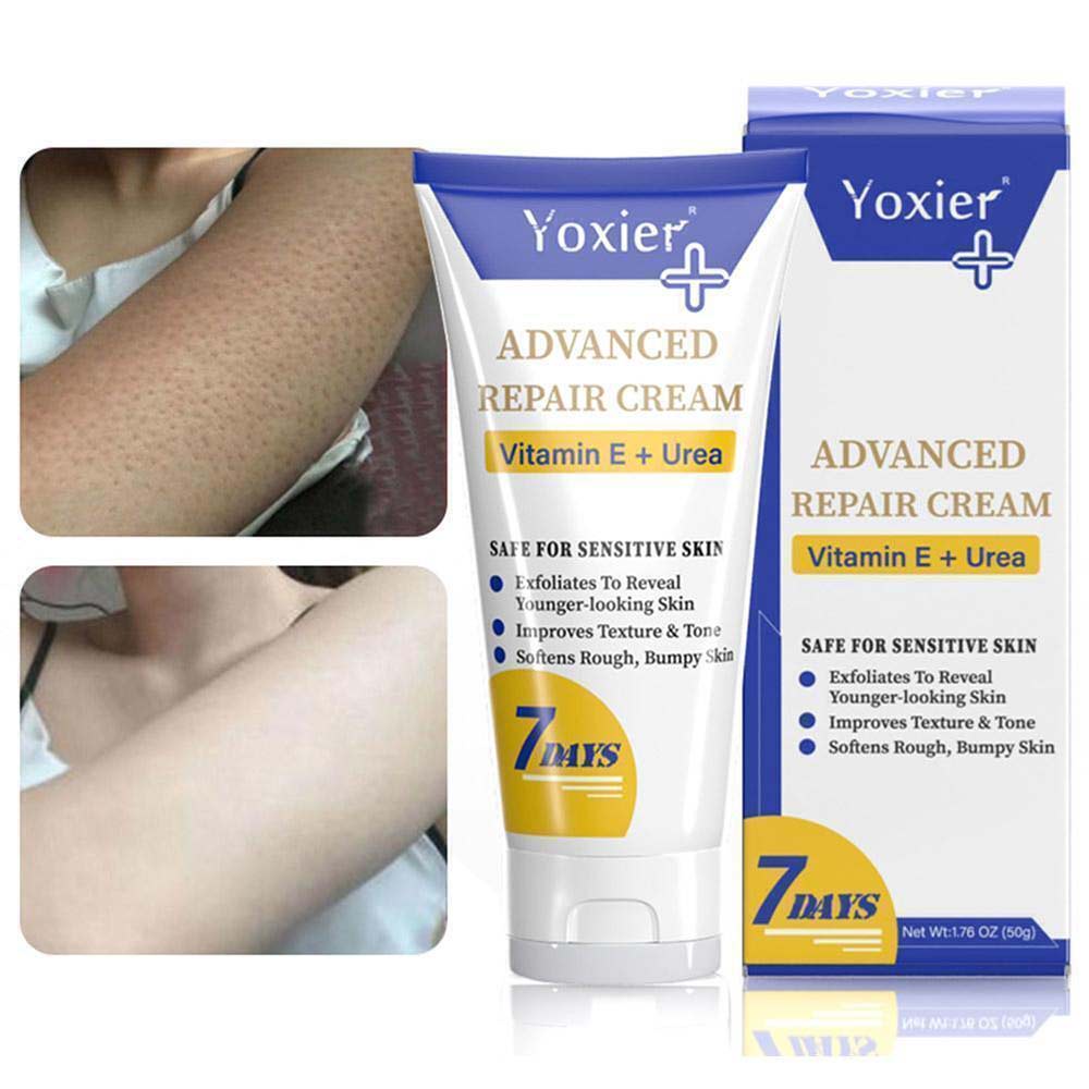 Yoxier Advanced Moisturizing Repair Cream Body Moisturizing Cream For The Treatment Of Pruritus 5370