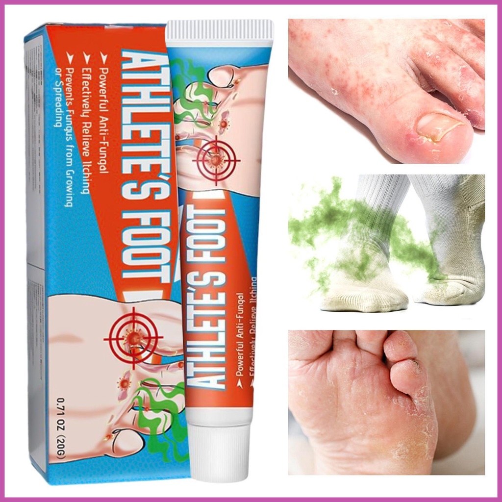 Toenail Anti Fungal Athlete's Foot Cream Pen Nail Treatment Fungus ...