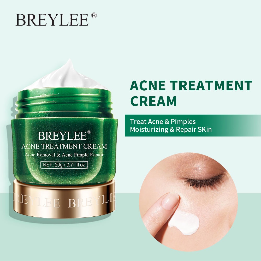 BREYLEE Acne Treatment Cream Pimple Removal Spots Oil Control Anti Acne