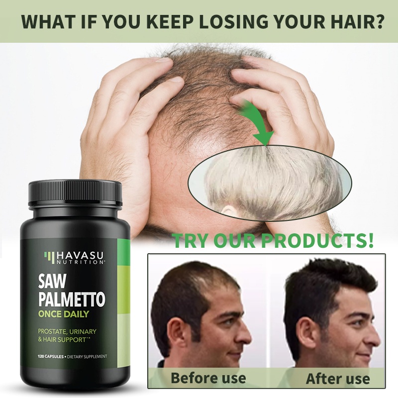Curated visual reference: Saw Palmetto Supplement As Dht Blocker For Men S Hair Photo Inspiration