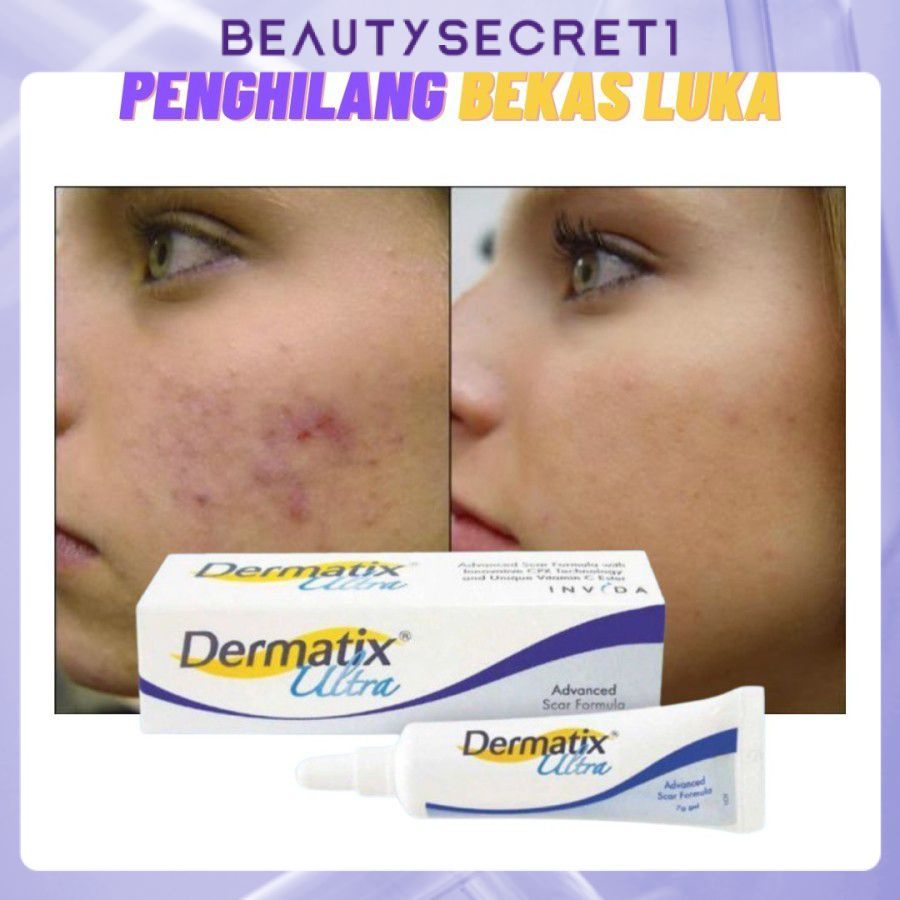 Dermatix Effective Scar Removal Cream Scar Gel Old Scars Acne Scars