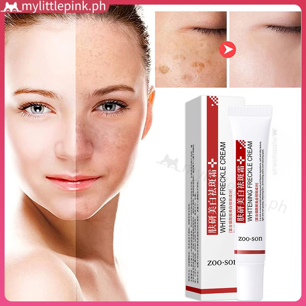 ZOO·SON Skin Whitening Freckle Cream Removing Pigmentation ...