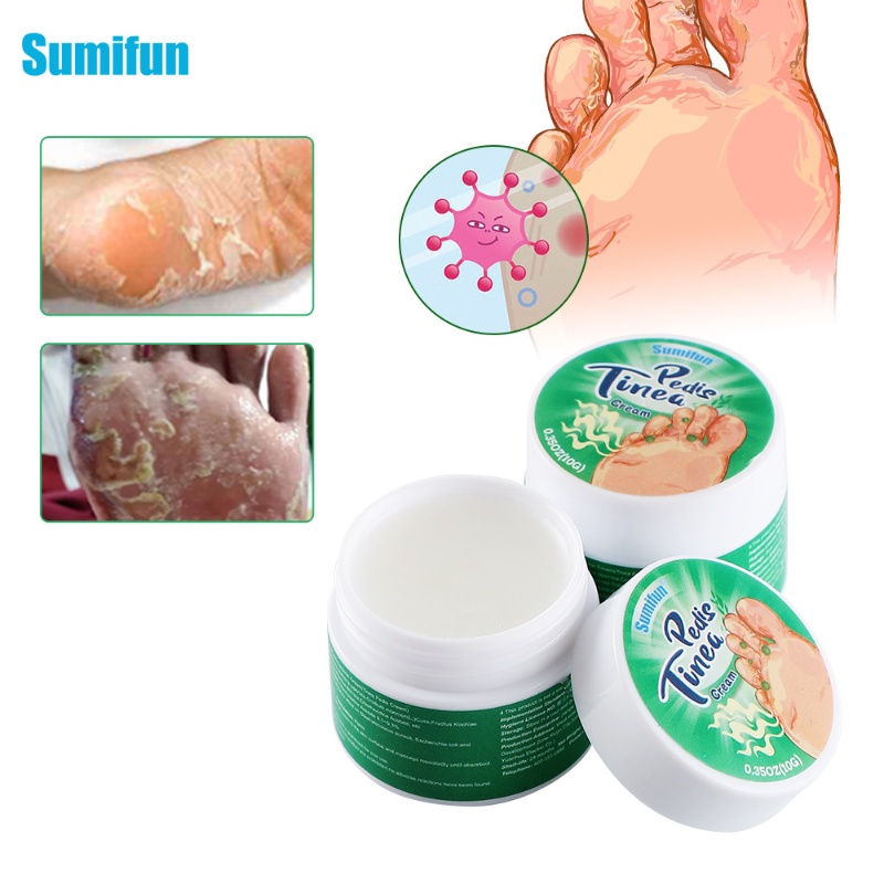 In StockM3 Foot Beriberi Anti Itch Cream Tinea Pedis remove dry cracked ...