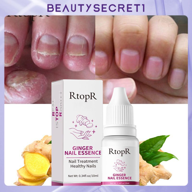 rtopr-ginger-antibacterial-nail-treatment-essential-anti-fungal