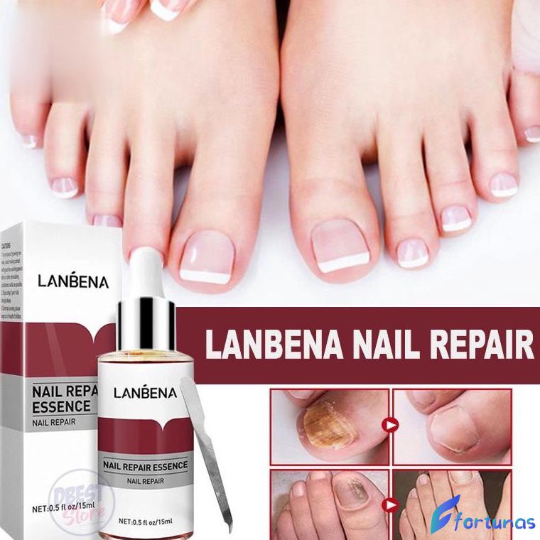 Lanbena Fungal Nail Repair Essence Serum Treatment Care Foot Nail
