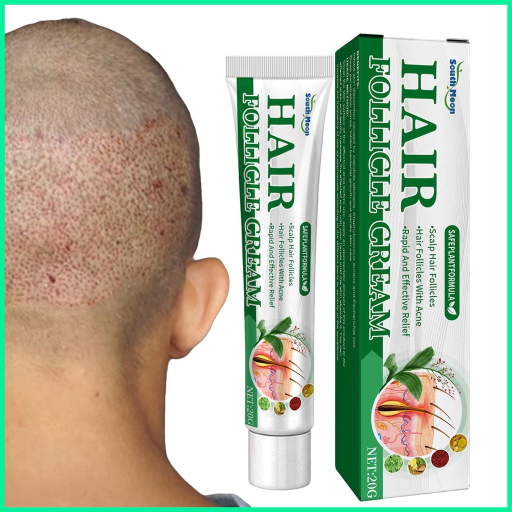 Folliculitis Cream Scalp Hair Folliculitis Herbs Treatment Pustules