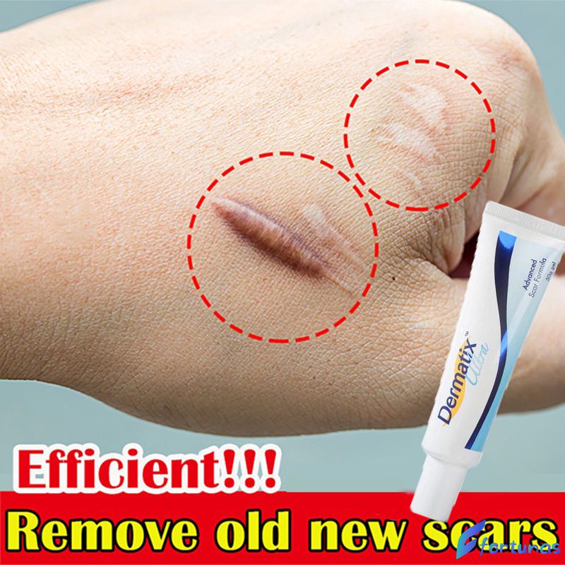 Australia Dermatix Scar Silicone Gel Ointment Scars Caesarean Section