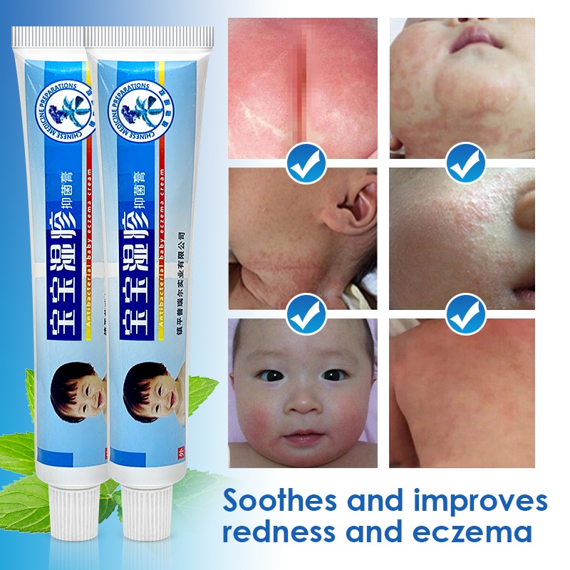 sebamed-baby-rash-cream-online-get-relief-from-diaper-rash