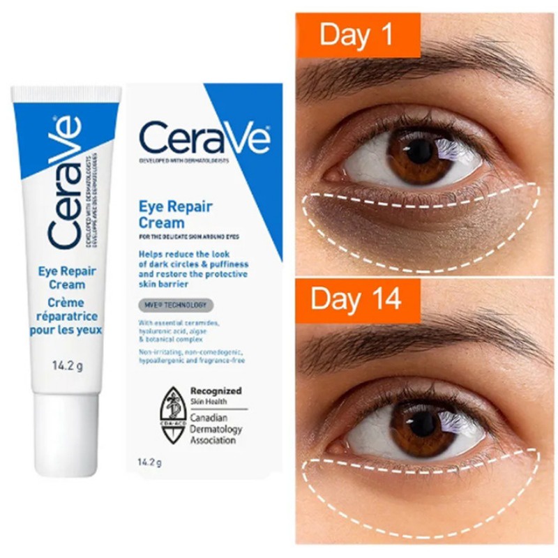 Cerave Eye Cream Repair Skin Barrier For Dark Circles Under Eyes