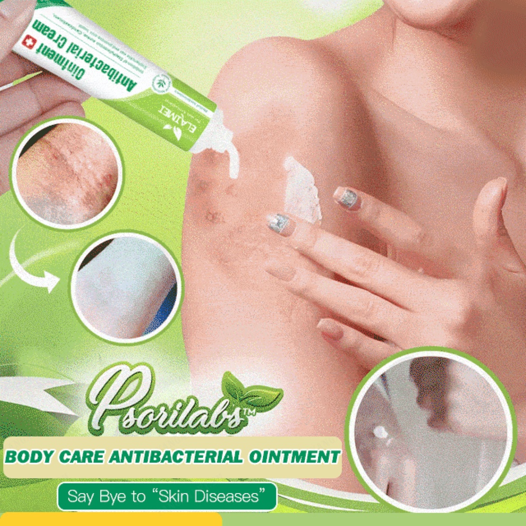 Mosquito Bite Relief Ointment for Effective Itch Relief Shopee