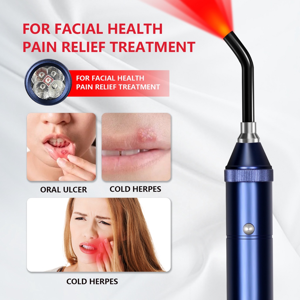 Pain relief Red Light Treatment for cold sores and canker sores