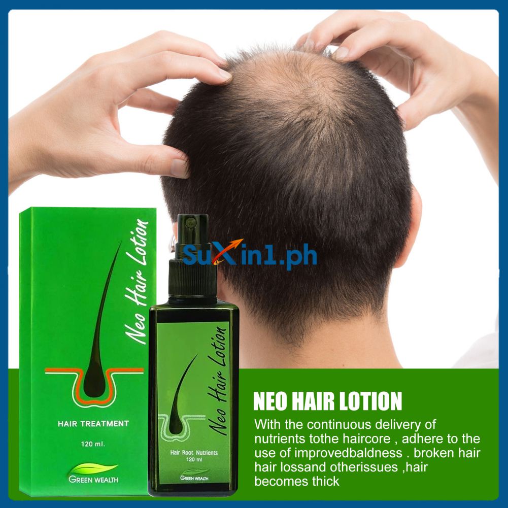 Thinning Hair Treatment Bestselling Hair Growth Product Thailand Hair