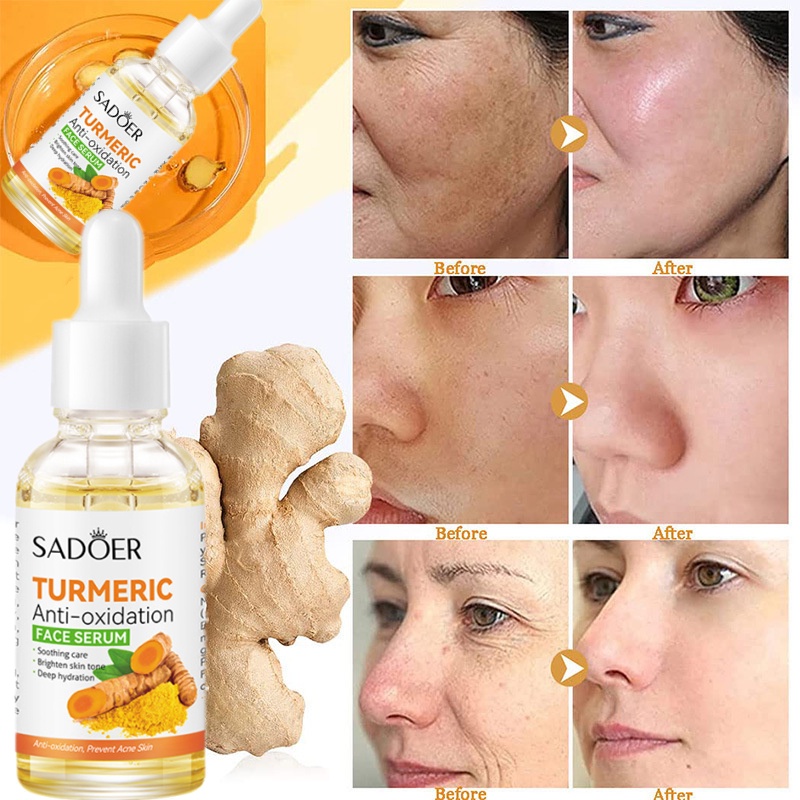 SADOER Turmeric Anti-Oxidation Face Serum 30ml Anti-Wrinkle Facial Skin  Lighten Spots Repair Dullness Oxidation Brighten Skin - Shopee Philippines
