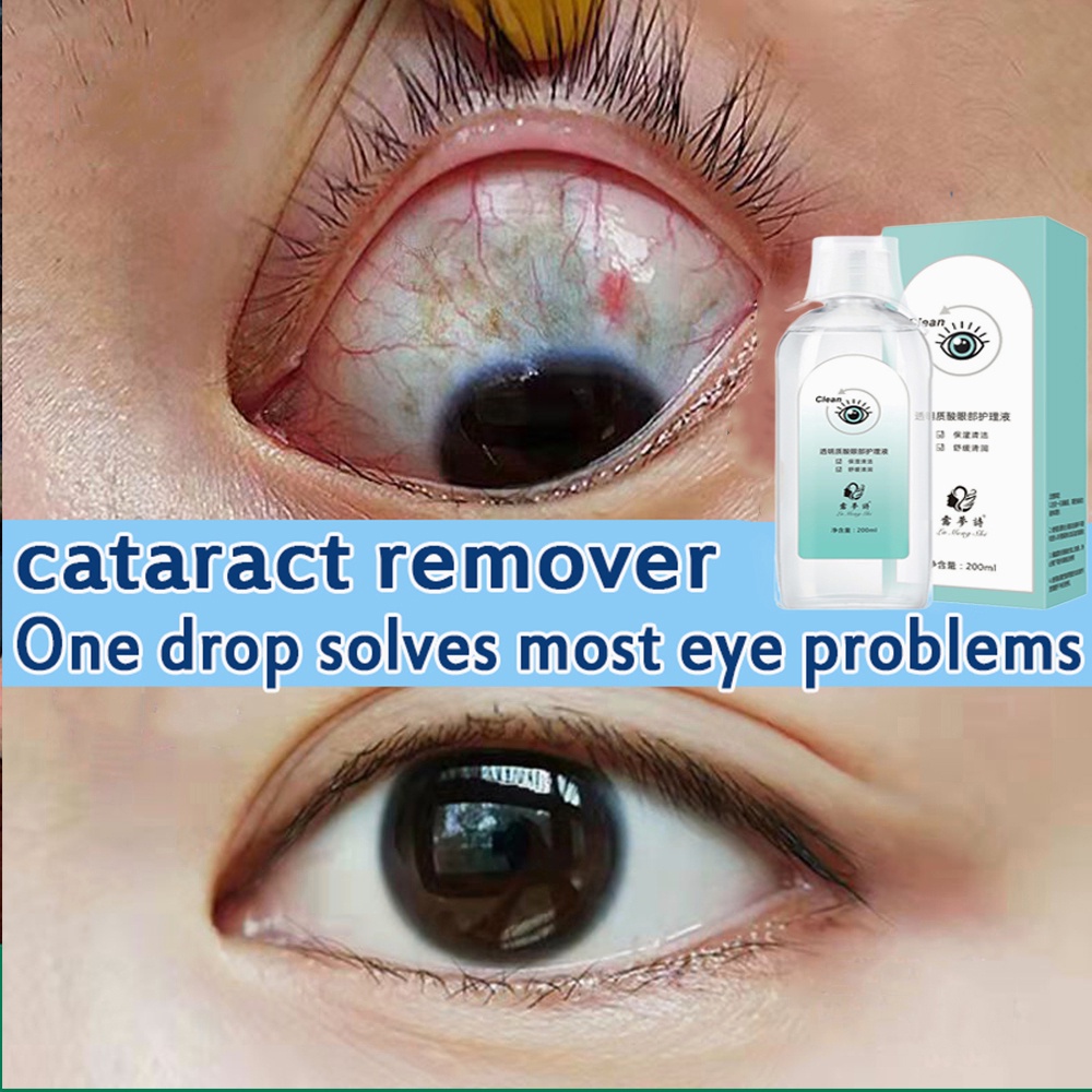 Eye Drops for cataract Medical Eye Wash dry eyes drops CleanerItchy