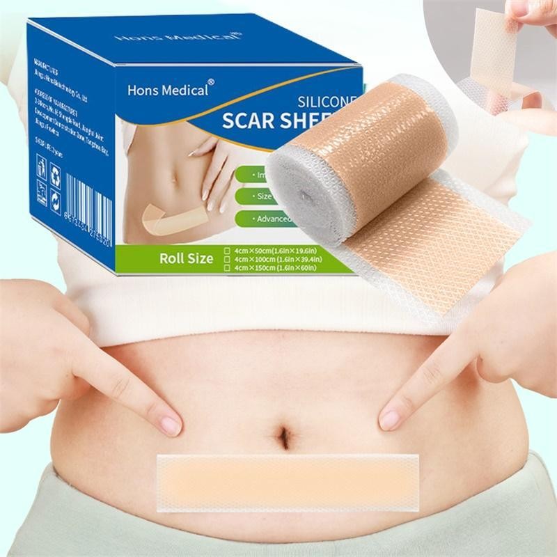 Silicone Scar Tape Scar Stickers Silicone Scar Tape Self-Adhesive ...