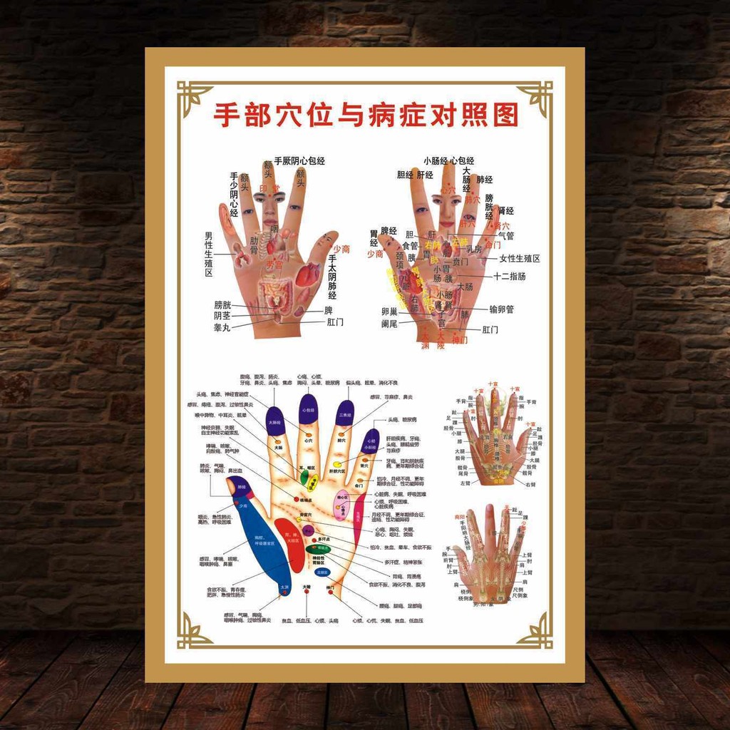 Hand Acupuncture Chart Hand Reflex Area Wall Chart Human Hand Acupoint ...