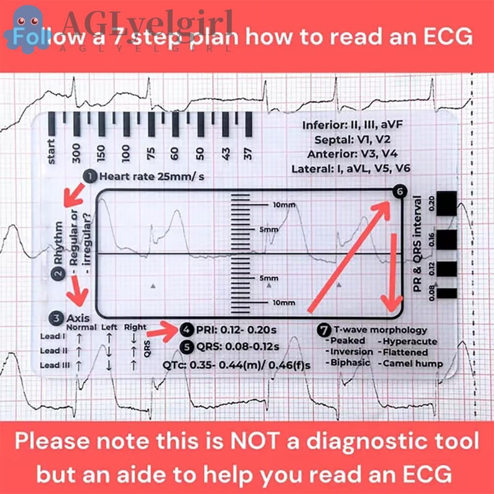 AGLYELGIRL EKG Calipers, ECG/EKG Transparent ECG 7 Step Ruler, Plastic ...