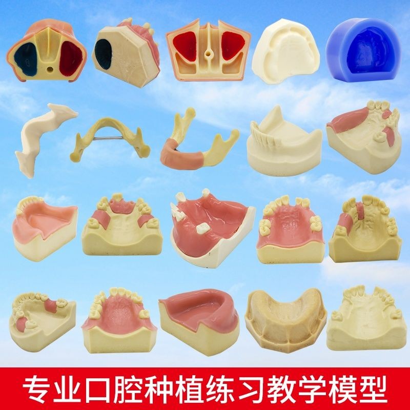 Yixi Dental Material Planting Practice Model Upper Jaw Tooth Planting ...
