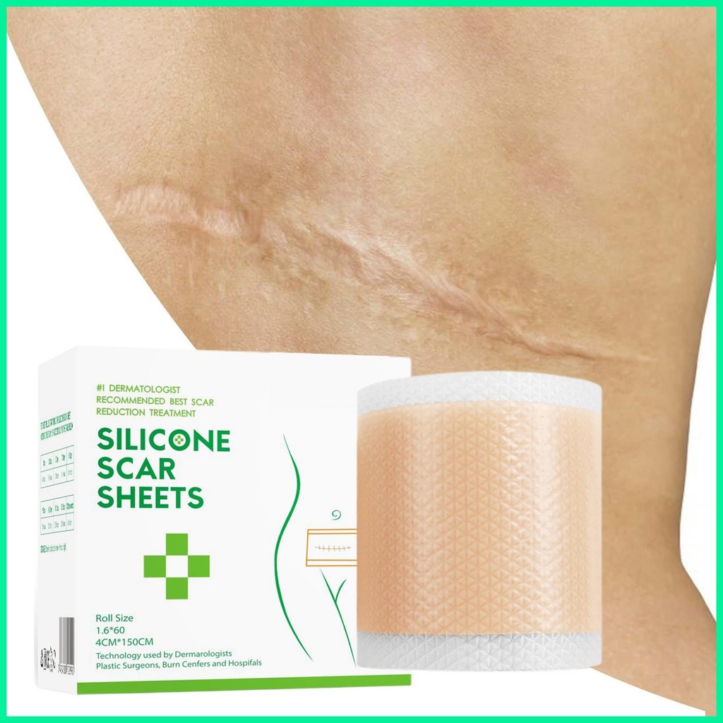 Silicone Scar Tape, Silicone Scar Sheets, Scar Tape Iceland - View #3