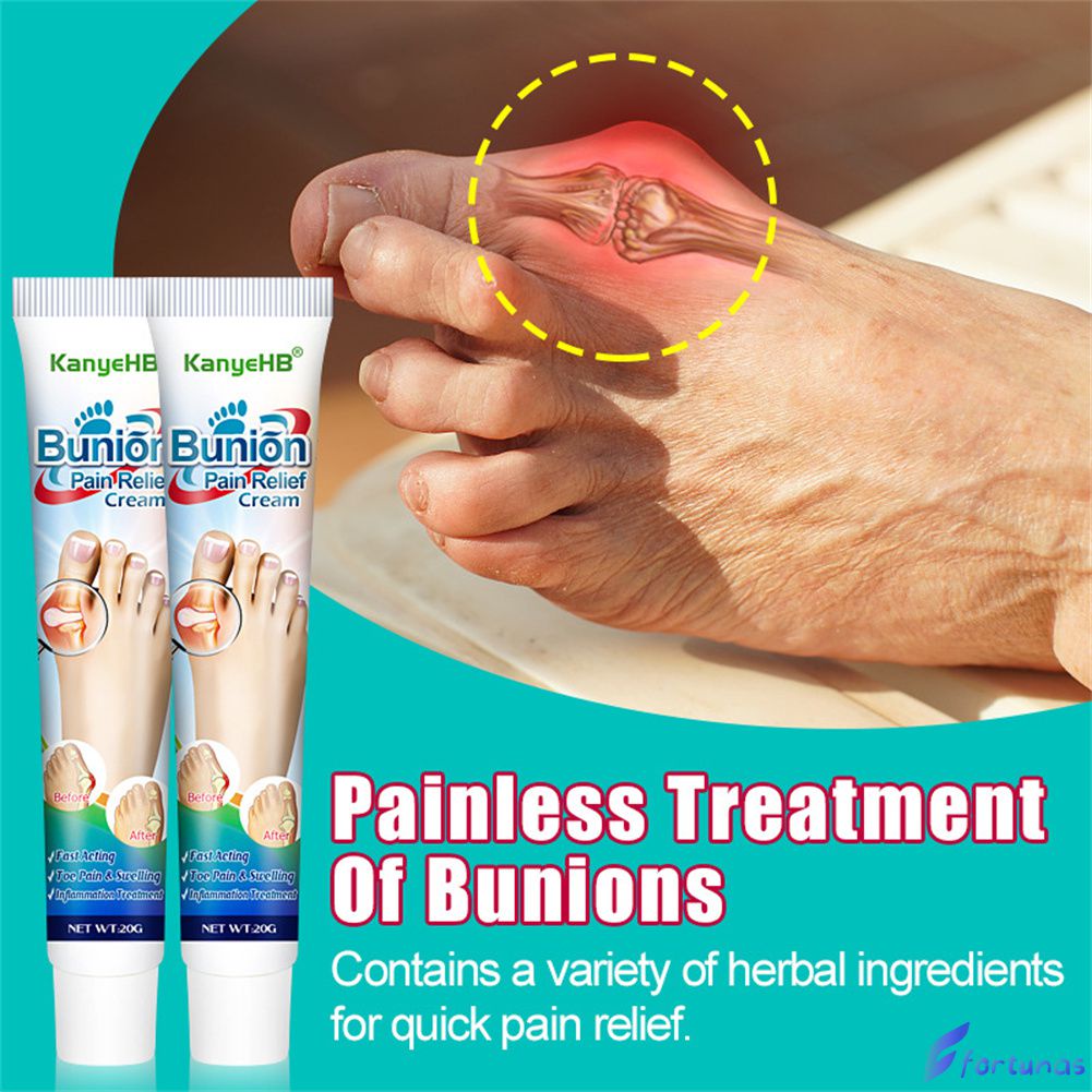 Kanyehb 20g Bunion Gout Pain Relief Ointment Toe Joint Valgus Corrector