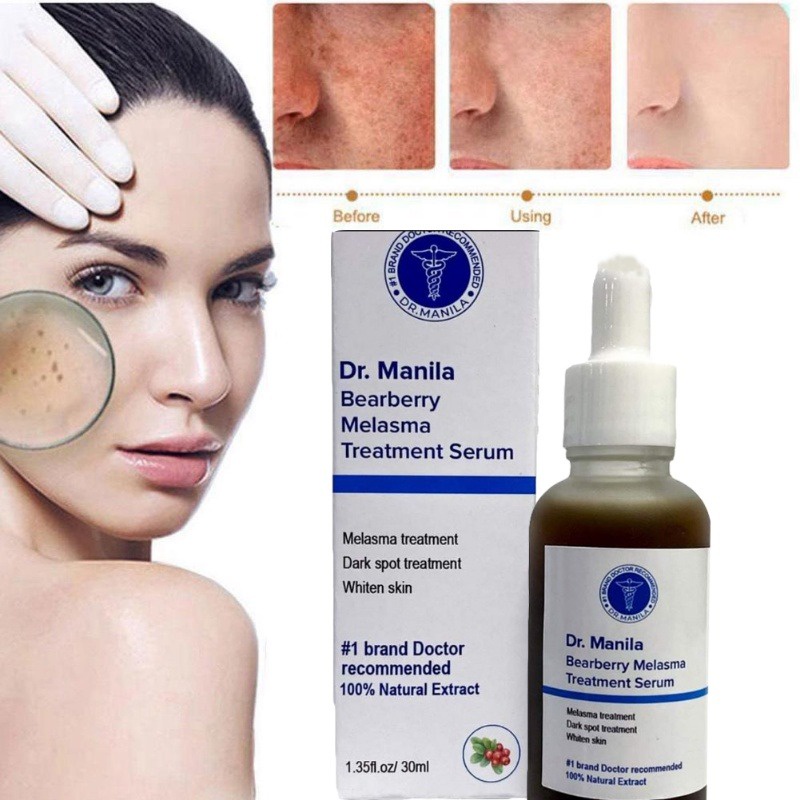 DR Manila Bearberry Melasma Treatment Serum ( No.1 Treatment For ...