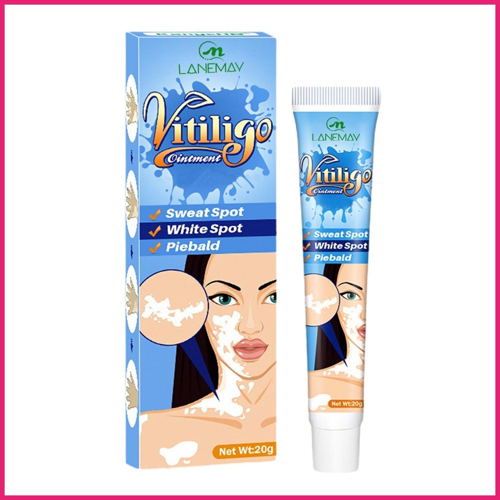 Ringworm Remove Cream 0.7oz Herbal Extract Reduce Melanin Deposits