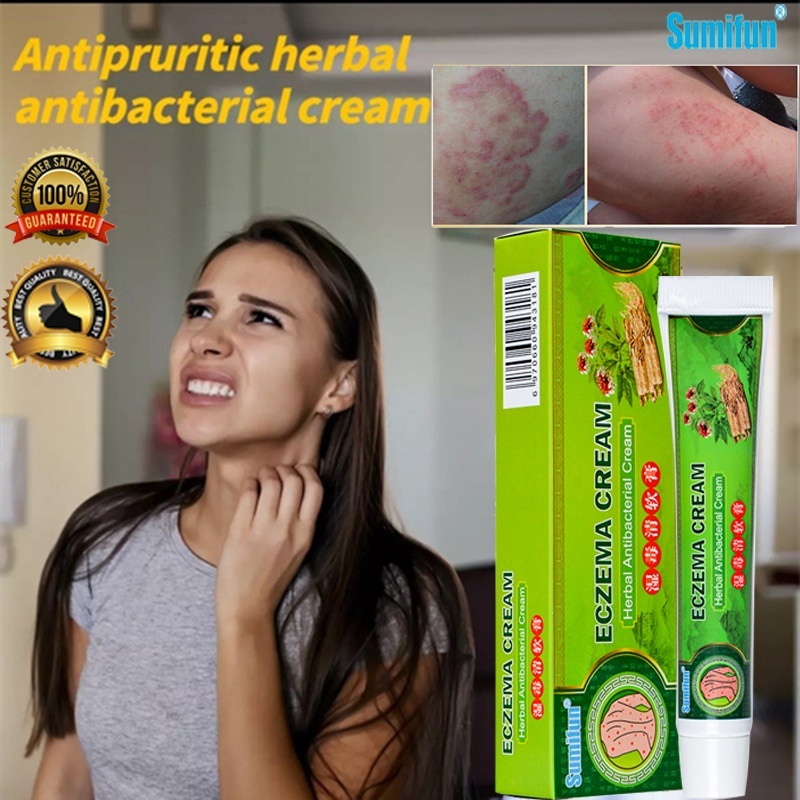 【100 Effective】 Eczema Cream Anti Itch Cream gamot sa kati sa balat
