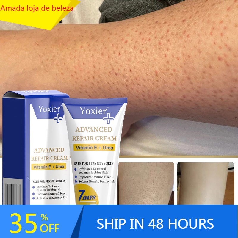 Vitamin E Repair Cream Moisturizing Improves Dry Rough Bulging Skin