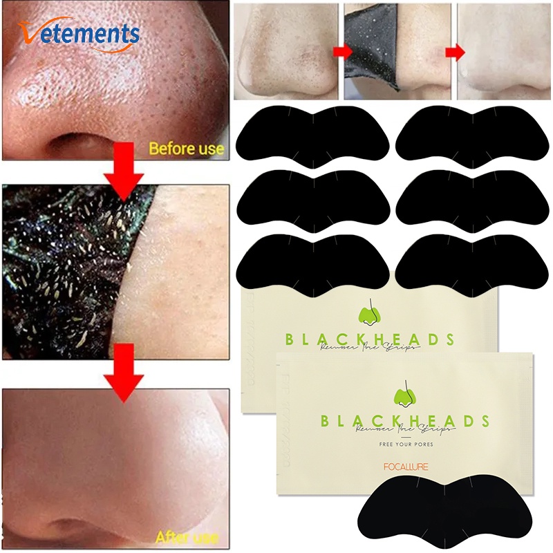 Multi Style Blackhead Remove Nose Mask Deep Cleansing Shrink Pore Peel