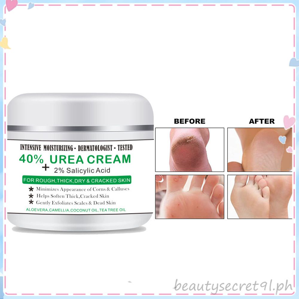 Crazylife 40% Urea Cream Heel Dry Cracked Foot Cream Foot Hand Crack ...