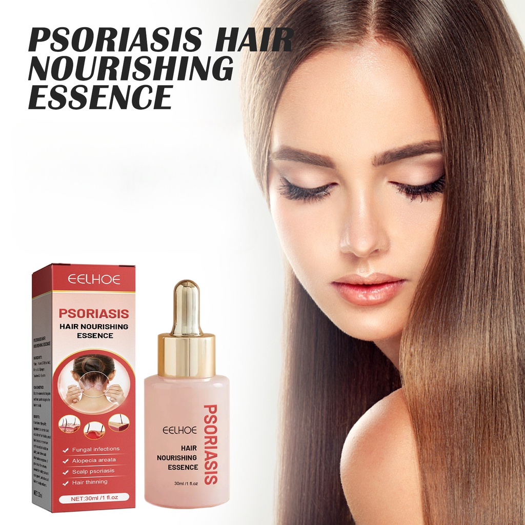 FREEGO 30ml Psoriasis Scalp Treatment Serum Dandruff Removal Anti Itchy