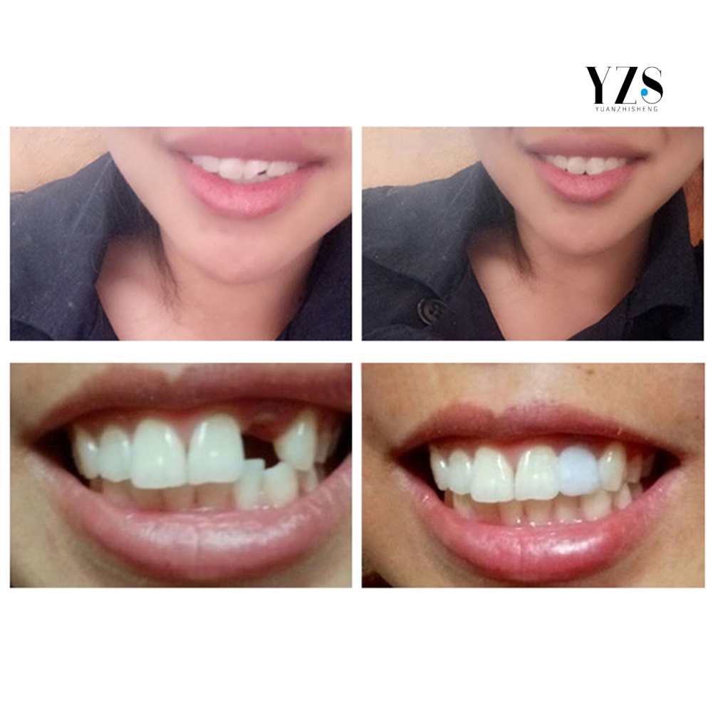 BY3/10/20ml DIY Temporary Tooth Filling Material Missing Teeth Repair
