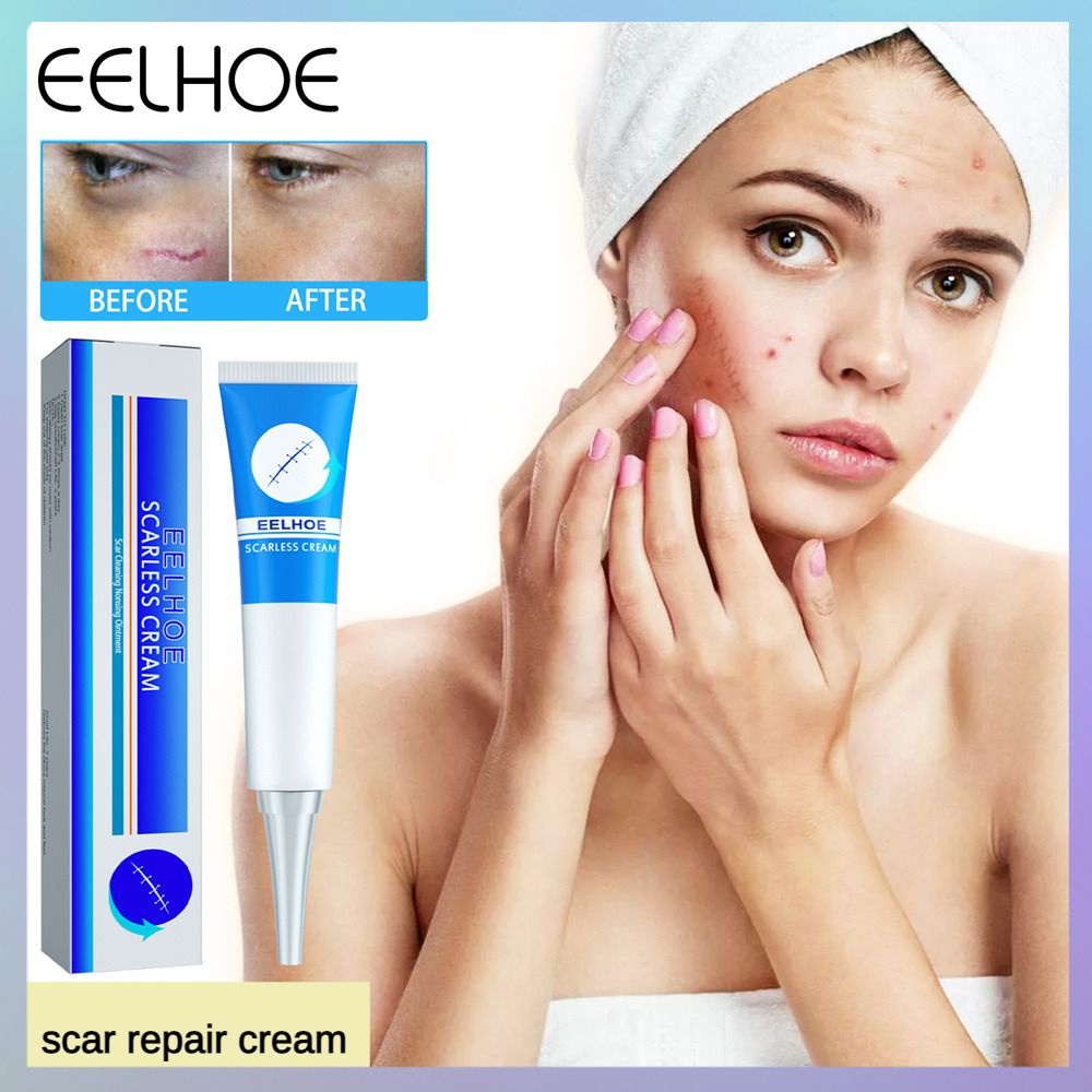 Health Care Surgical Scar Cream Natural Ingredients Repair Cream Best