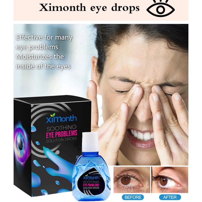 Eyestrain Relief Eye Drops Nourishing Eye Care Dry Itchy Eye Drops Eye Drops Shopee