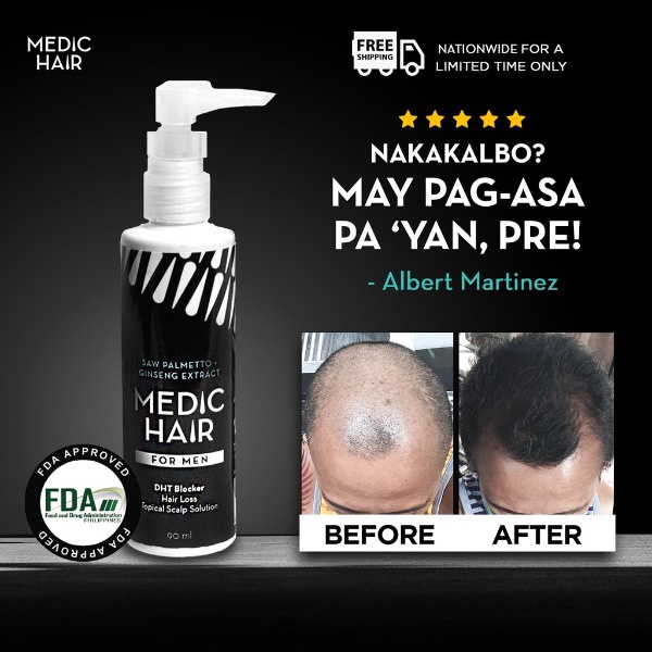 Medic Hair for Men Hair Regrowth Formula (90 ML) Shopee Philippines