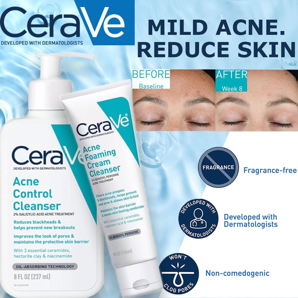 CeraVe Acne Control Cleanser Acne Foaming Cream Cleanser | Shopee ...