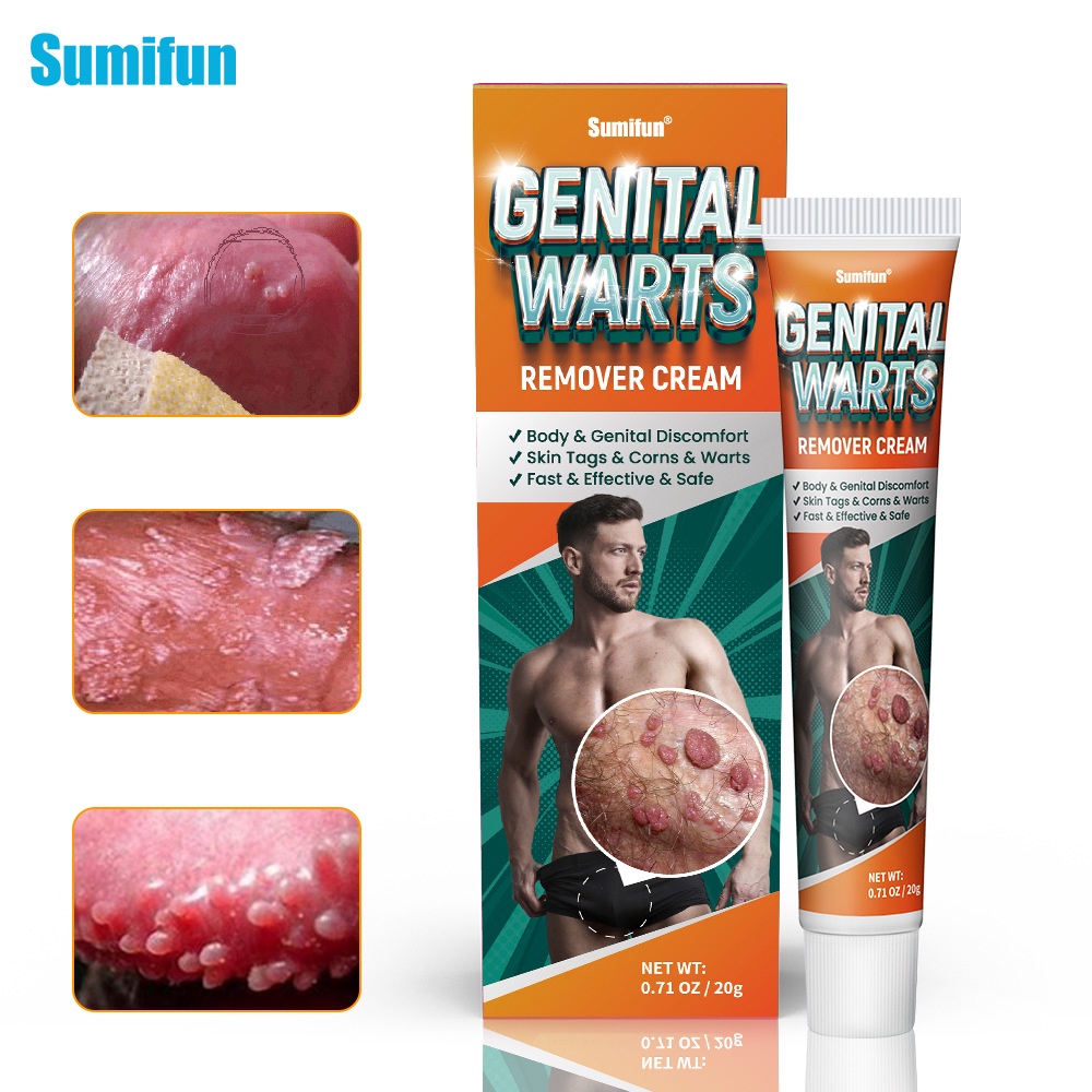 Genital Warts Removal Ointment Pimple Skin Tag Remover Cream Papilloma Moles Herpes Killer Men