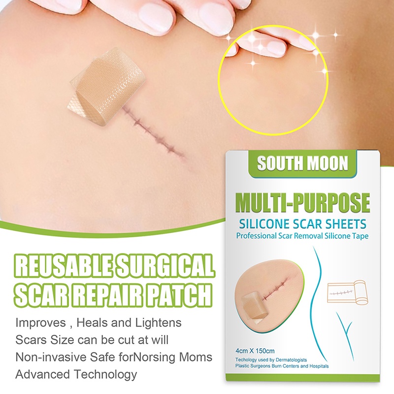 LYN 4cm*1.5m Surgery Scar Removal Sticker Sheet Patch Silicone Gel ...