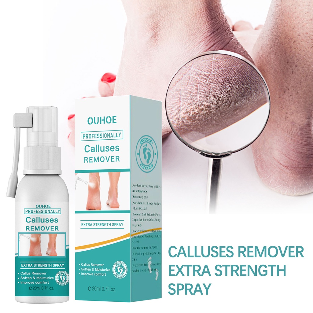 OUHOE Calluses Remover Extra Strength Spray Foot Cracking Spray Anti