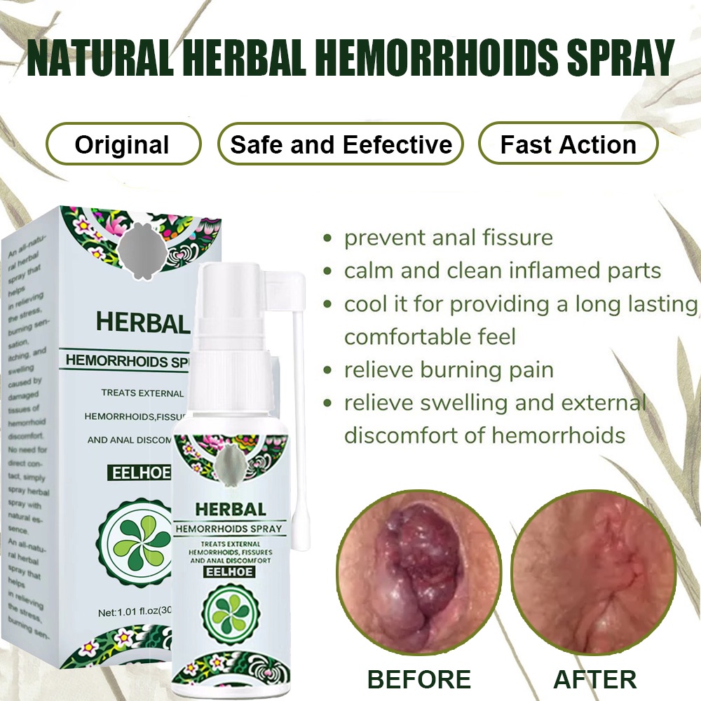 Natural Herbal Hemorrhoids Spray Fast AntiItchy Hemorrhoids Remover