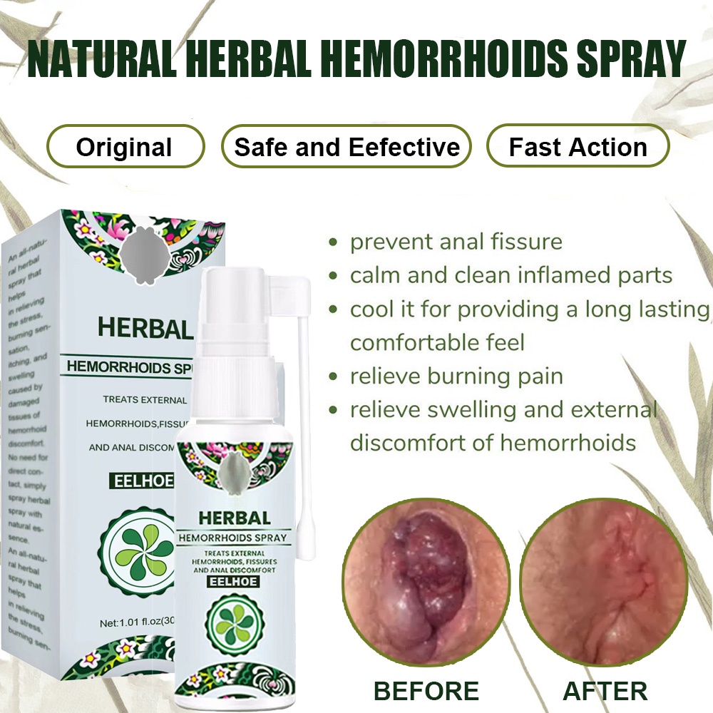 Natural Herbal Hemorrhoids Spray Fast Anti-Itchy Hemorrhoids Remover ...