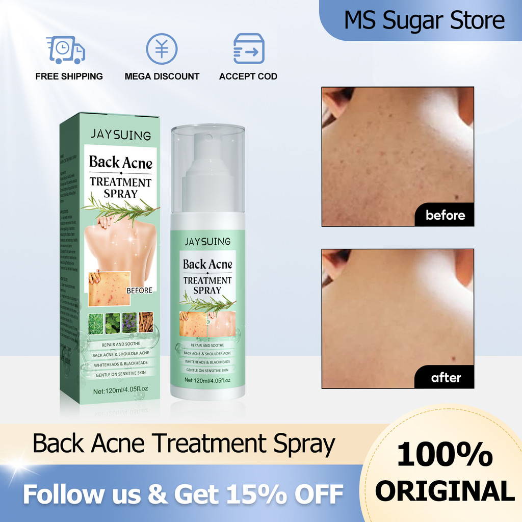 Jaysuing Back Pimple Acne Treatment Spray 120ml Acne Back Spray Shrink ...