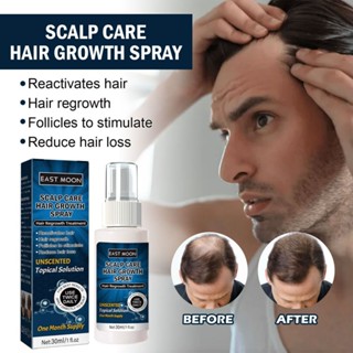 【BUY 1 TAKE 1】East moon minoxidil hair grower for men and Women Hair ...