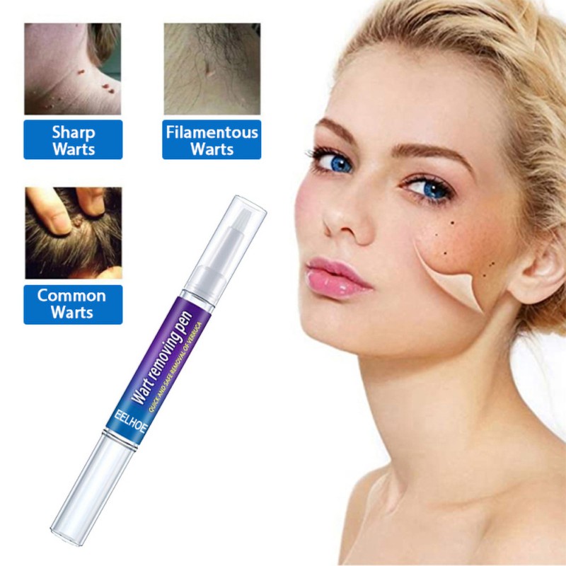 Wart Removal Liquid Acne Plantar Wart Corn Callus Skin Tag Remover Pen