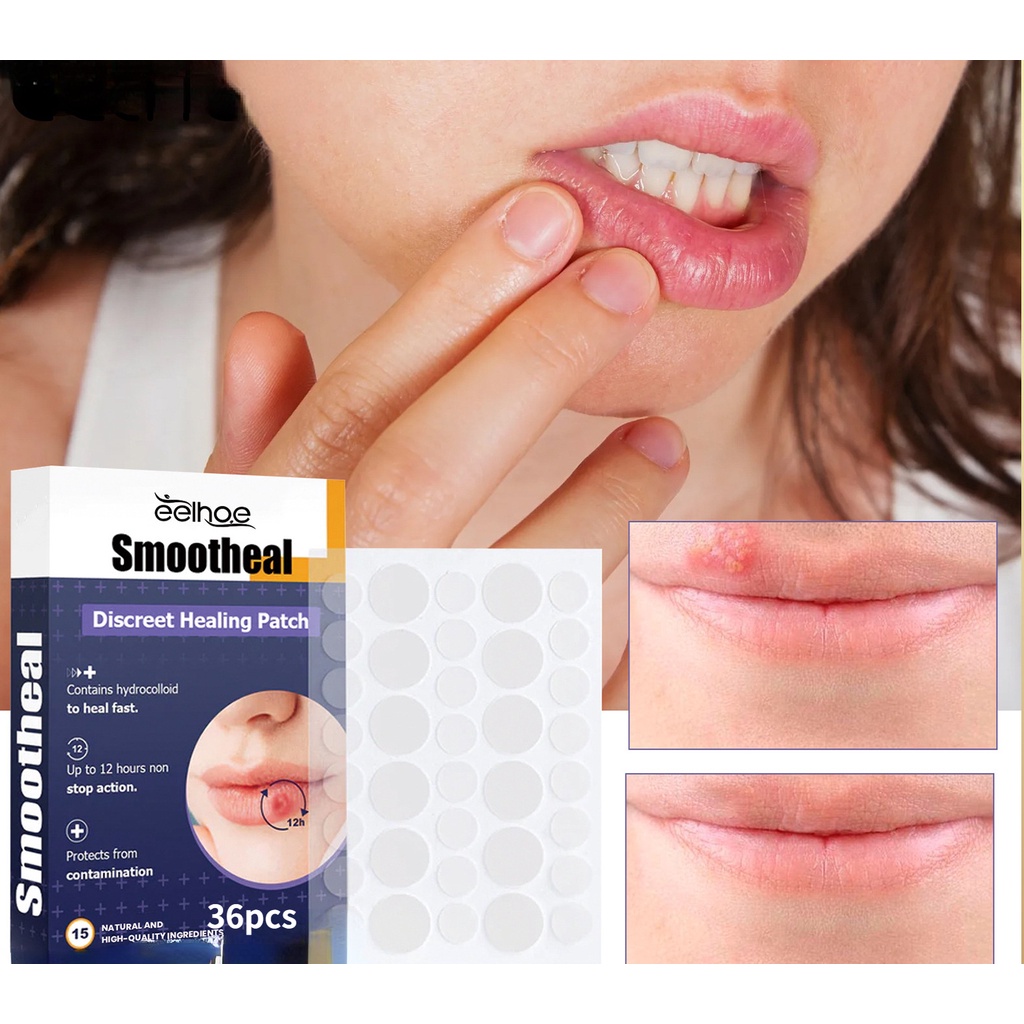Invisible Herpes Patches Invisible Cold Sore Patches 36pcs/box
