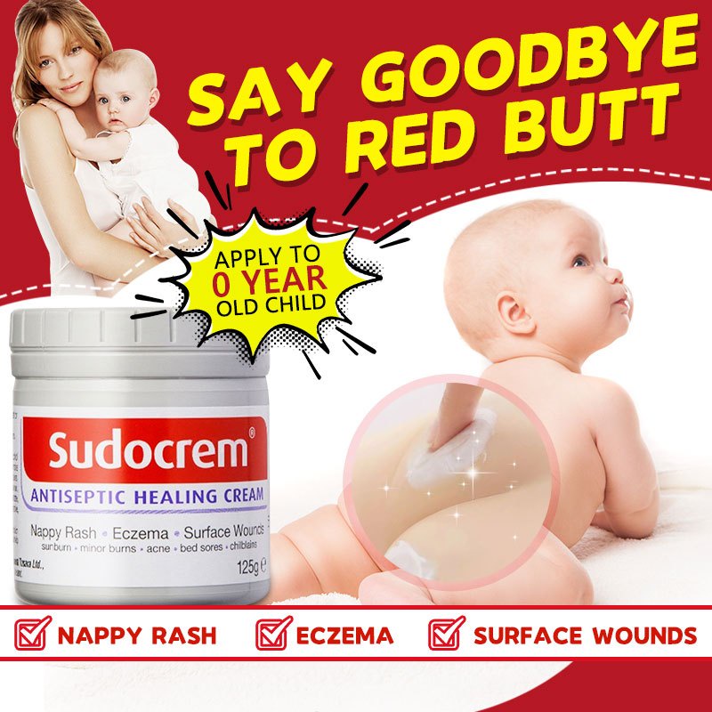 Sudocrem best sale sunburn baby