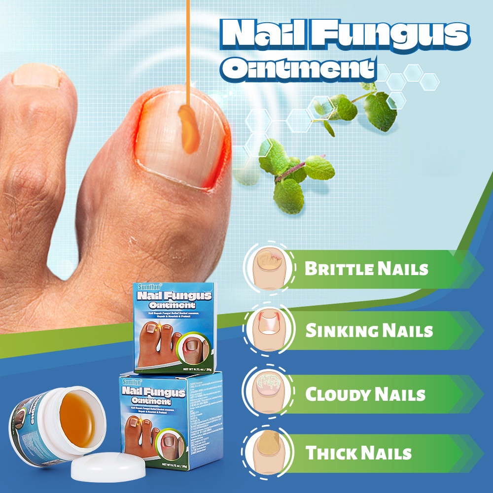 Nail Fungus Treatments Serum Cream Anti Fungal Foot Toe Nails Repair Gel AntiInfection