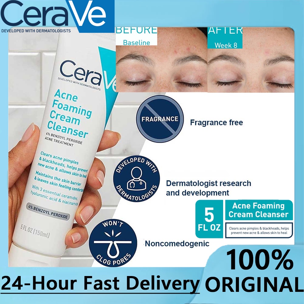 CeraVe Acne Foaming Cleanser 150ml Developed with Dermatologists Acne
